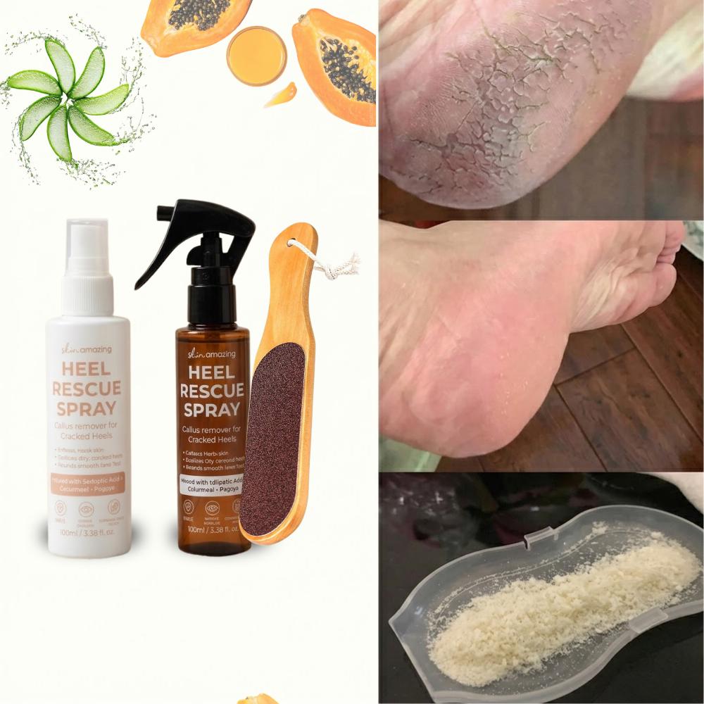 Skin Amazing Heel Rescue Spray – Callus Remover for Dry, Cracked Heels | Foot Care Spray Smooth Hydrating