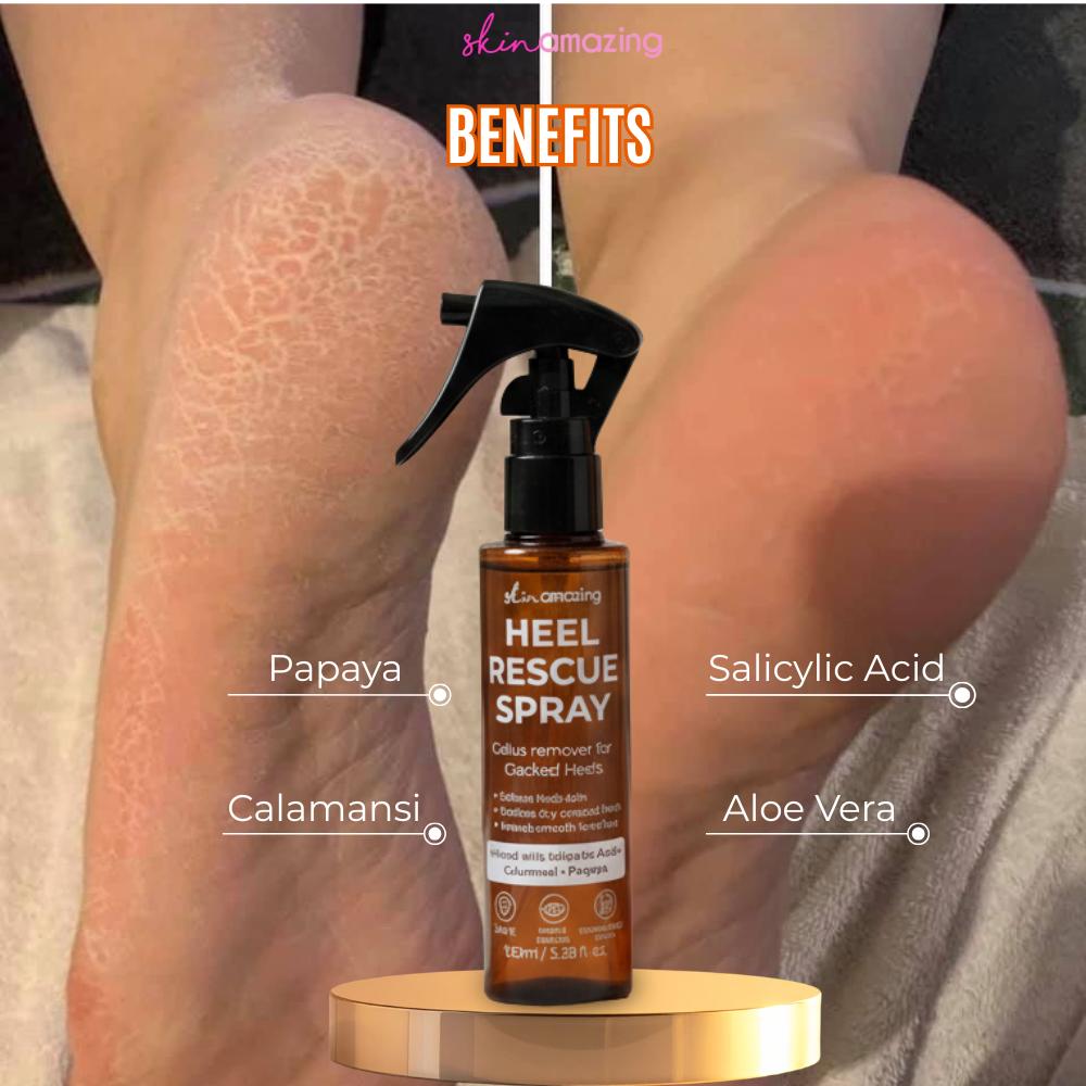 Skin Amazing Heel Rescue Spray – Callus Remover for Dry, Cracked Heels | Foot Care Spray Smooth Hydrating